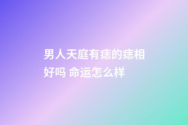 男人天庭有痣的痣相好吗 命运怎么样